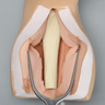 Intraosseous Access Injection Trainer