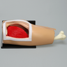 Arthroscopy Hip on Basic Stand with Posterolateral Window