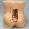 Vertebroplasty Trunk, Short