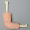 Elbow with Nerve, Tendon, and Four-Part Humeral Fracture, Encased