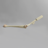 Arthroscopy Elbow with Reusable Portals