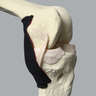 Knee, ACL with Drill Tunnels, Solid Foam