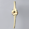 Knee, ACL with 3.2 mm/10 mm Step Tunnel , Solid Foam