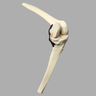 Knee, ACL with 3.2 mm/10 mm Step Tunnel , Solid Foam