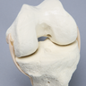 Knee, ACL Demonstrator, Solid Foam