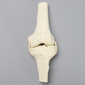 Knee, ACL Demonstrator, Solid Foam