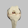 Knee Insert, Encapsulated ACL, Large