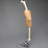 Knee, Encased with Incision Points
