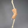Knee, Encased with Incision Points