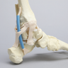 Able Advanced Arthroscopy Ankle