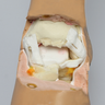 Archie Advanced Arthroscopy Ankle