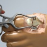 Archie Advanced Arthroscopy Ankle