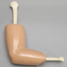 Arthroscopy Elbow without Clamps Arthroscopy Elbow without Clamps