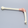 Arthroscopy Elbow Insert