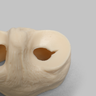 Meniscal Insert with Flap, Transverse, and Longitudinal Tears
