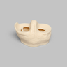 Meniscal Insert with Flap, Transverse, and Longitudinal Tears