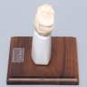 Tibial Plug