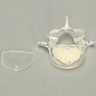 Vertebra L5 with Replaceable Insert, Transparent Cortical