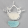 Vertebra, L5, With Replaceable Insert, 4mm Pedicle Entry Sites, Transparent Cortical