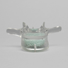 Vertebra L3 with Replaceable Cancellous Insert