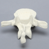Vertebra, L1, Fractured, Solid Foam