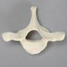 Vertebra, T1, Foam Cortical