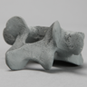 Vertebra, L5, Osteoporotic, Radiopaque