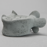 Vertebra, L5, Osteoporotic, Radiopaque