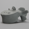 Vertebra, L4, Osteoporotic, Radiopaque