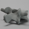 Vertebra, L4, Osteoporotic, Radiopaque