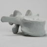 Vertebra, L3, Osteoporotic, Radiopaque