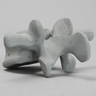 Vertebra, L3, Osteoporotic, Radiopaque