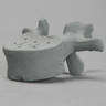 Vertebra, L1, Osteoporotic, Radiopaque