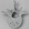 Vertebra, L1, Osteoporotic, Radiopaque