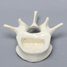 Vertebra, L4, Clear Window, Foam Cortical