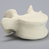 Vertebra, L5, Foam Cortical