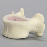 Vertebra, L5, Clear Window, Foam Cortical