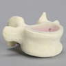 Vertebra, L5, Clear Window, Foam Cortical