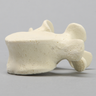 Vertebra, L5, Solid Foam