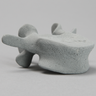 Vertebra, L4, Radiopaque