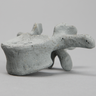 Vertebra, L2, Radiopaque