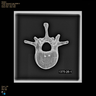 Vertebra, L1, Radiopaque