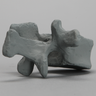 Vertebra, L1, Radiopaque