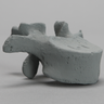 Vertebra, L1, Radiopaque