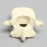 Vertebra, L4, Pediatric, Solid Foam