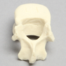 Vertebra, L1, Pediatric, Solid Foam