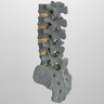 Spine, Lumbar, L1-Sacrum, Anterior and Posterior Ligaments, Radiopaque