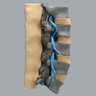 Spine, Lumbar with Nerve Roots, Flava and Interspinous Ligaments, Radiopaque
