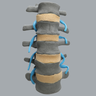 Spine, Lumbar with Nerve Roots, Flava and Interspinous Ligaments, Radiopaque