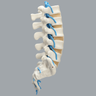 Spine, Lumbar with Blue Nerve Roots, Foam Cortical